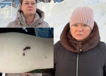 Глава СКР взял на контроль дело о нападении собаки на ребенка на проспекте Победы в Петропавловске